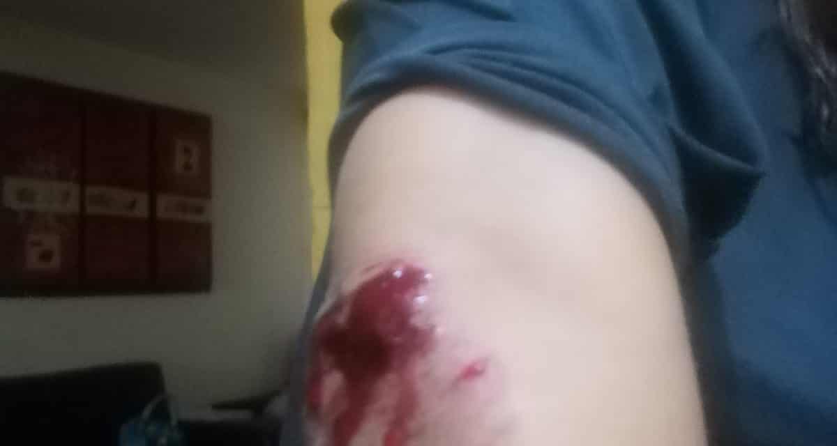 Lesionan severamente a periodista Paty Vela en intento de asalto en Veracruz puerto